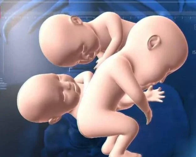 梦见怀了三胞胎_2