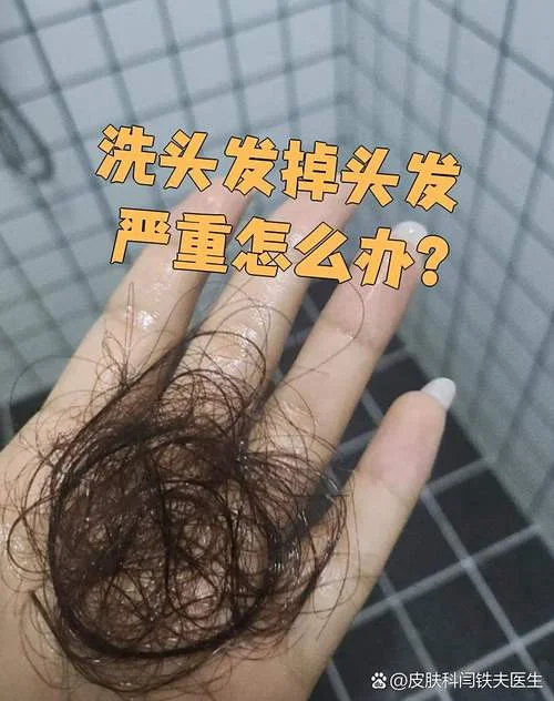 梦见掉发严重_1