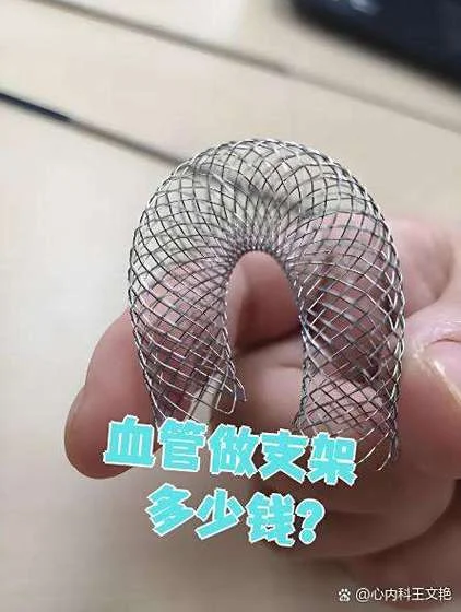 支架多少钱一个-支架价格每例