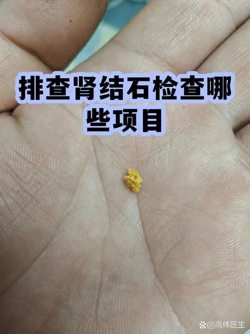 肾脏不好检查哪些项目_1