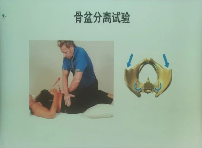 骨盆挤压试验怎么做_2