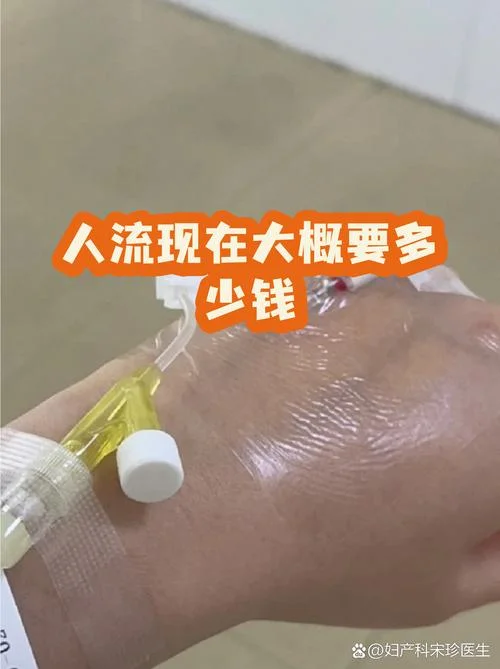 做无痛人流要多少钱呀_1