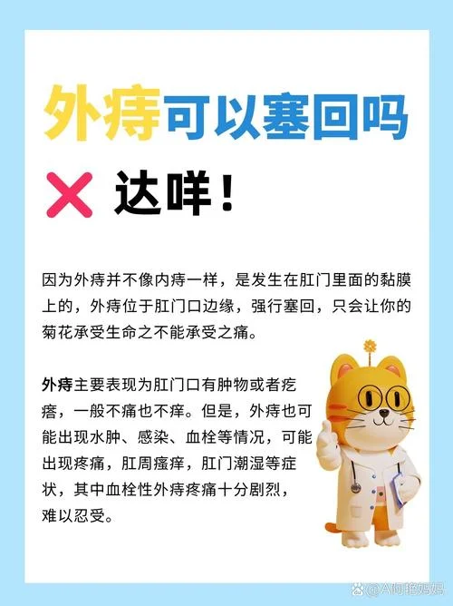 得了外痔怎么办-外痔怎么办