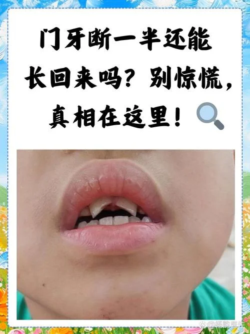 梦到自己门牙掉了_2