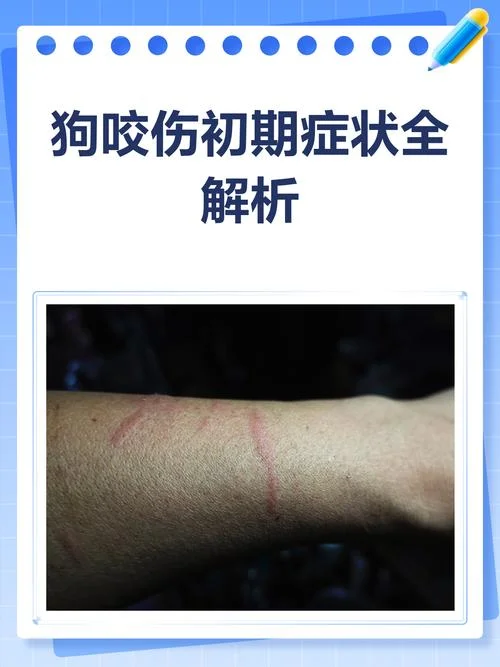 梦见狗把腿咬出血有什么预兆_1