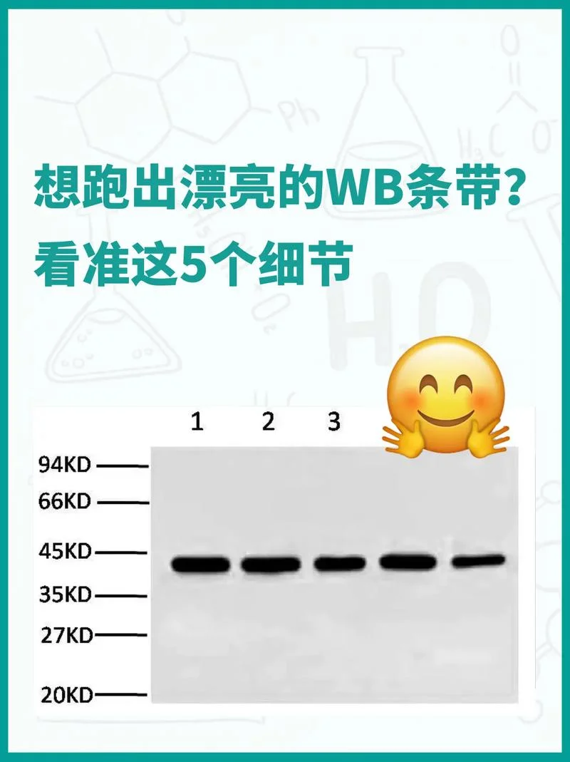 ob什么意思-ob 缩写别误解