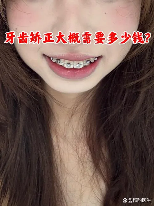 虎牙矫正大概需要多少钱_2