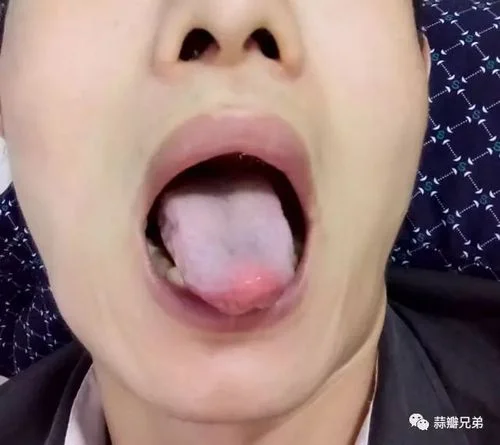 做梦舌头掉了怎么回事_1