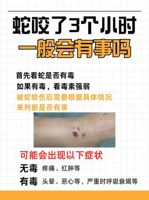 梦到被大蛇咬了_1