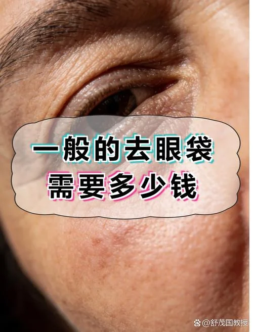 手术去眼袋大约要多少钱_2