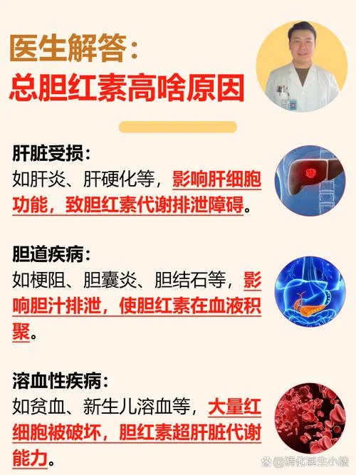 直接胆红素高什么意思-直接胆红素高值为何