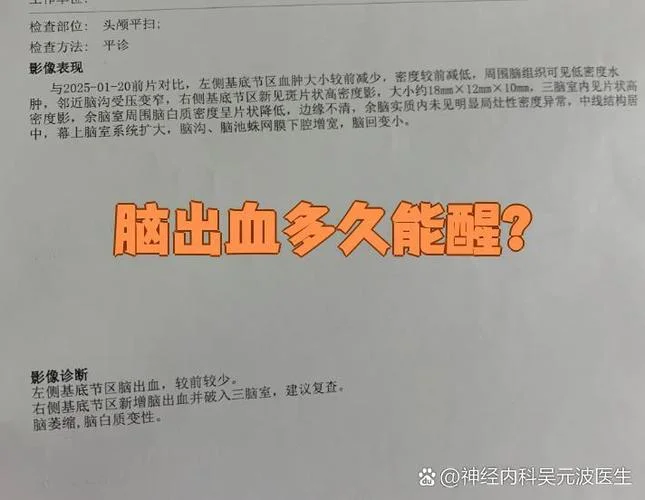 脑出血出血量计算公式_1
