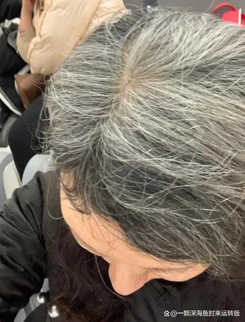 梦到自己白头发变黑了_1