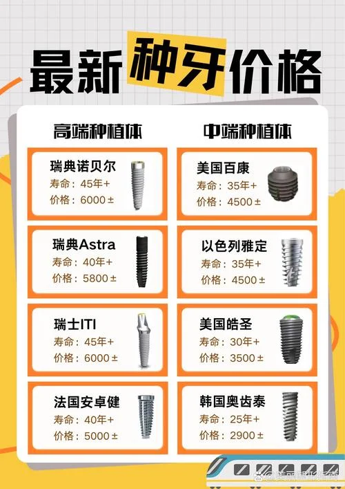 天津种植牙多少钱_2