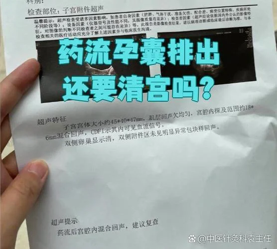 药流不干净清宫需要多少钱_1