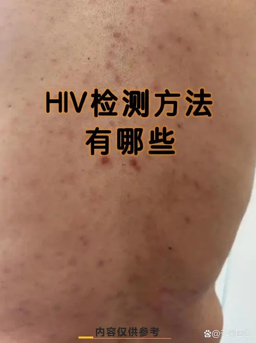 产检检查艾滋病是哪一年开始的-产检查艾滋始于哪年