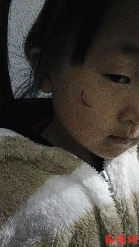 闺女梦见我的下巴掉了-闺女梦见下巴掉了