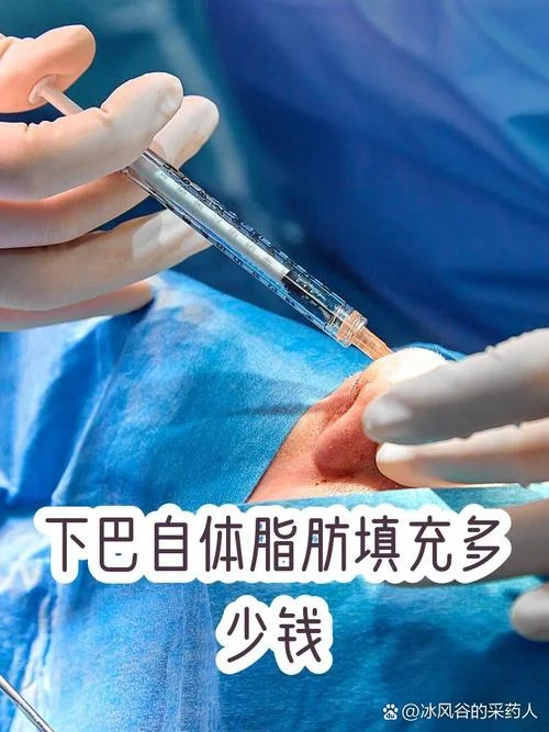 自体脂肪填一处多少钱_1
