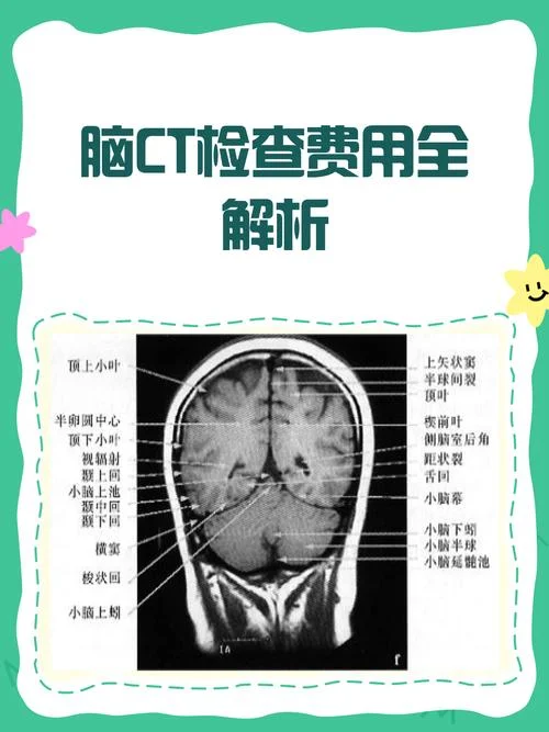 ct多少钱做一次_1