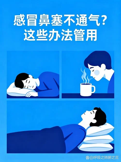 鼻塞的厉害怎么办_2