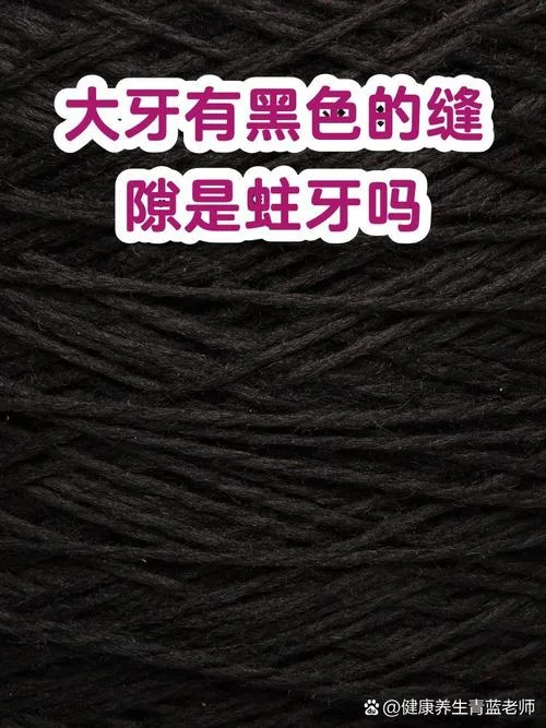 牙齿是黑色什么原因_2