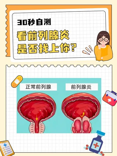 如何查前列腺炎_2