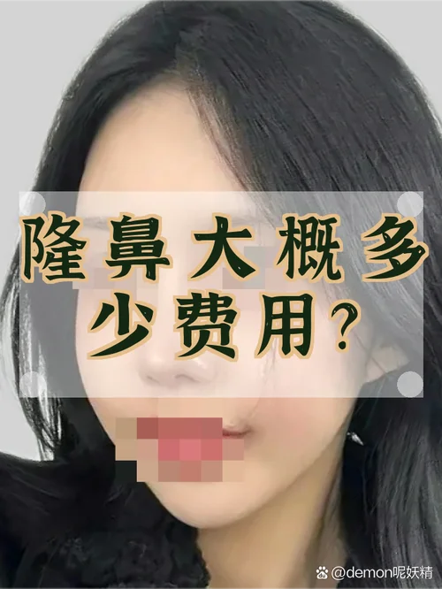 肋软骨隆鼻要多少钱_1