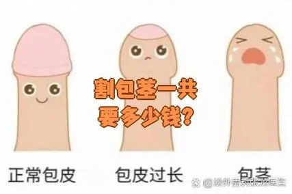 淄博包茎手术多少钱_2