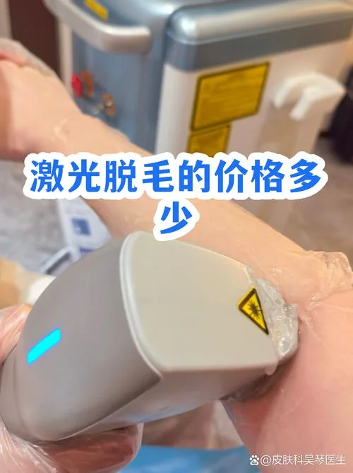 腋窝激光脱毛多少钱_1