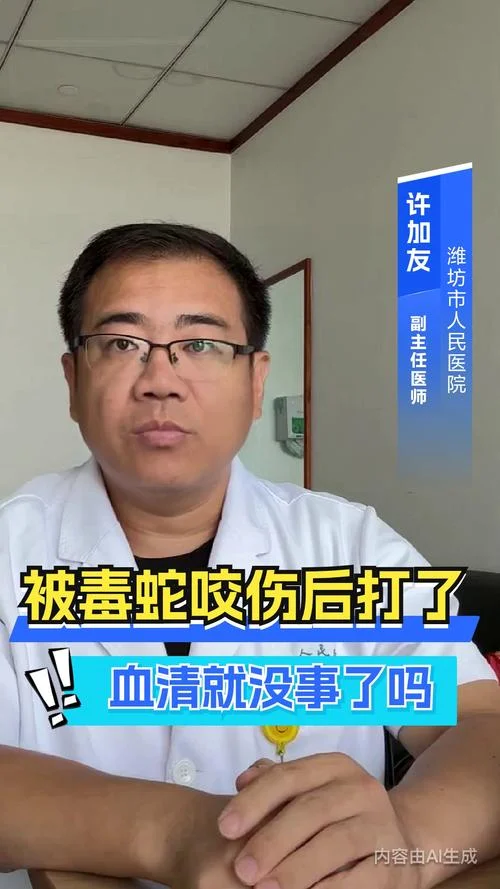 梦到被毒蛇咬又没事_1