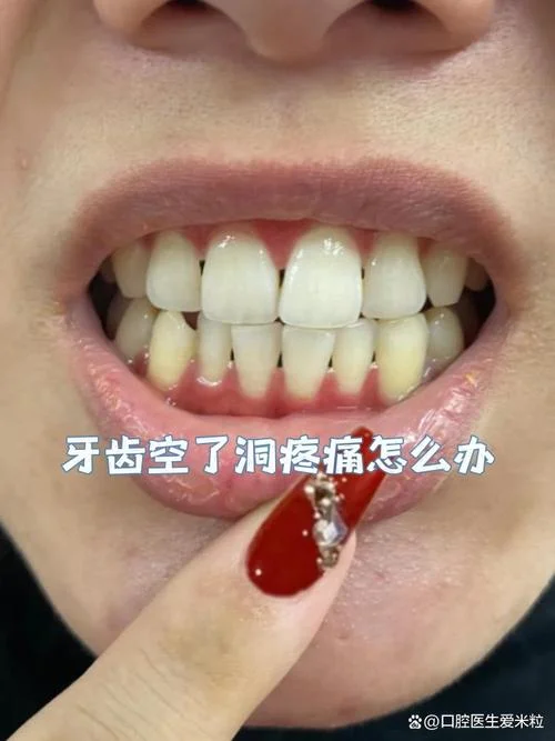 梦到牙洞_1