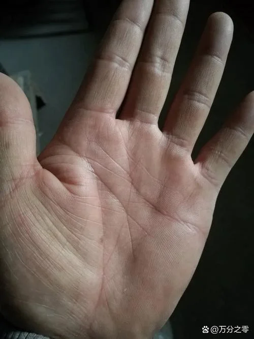 手相有鱼纹线_1