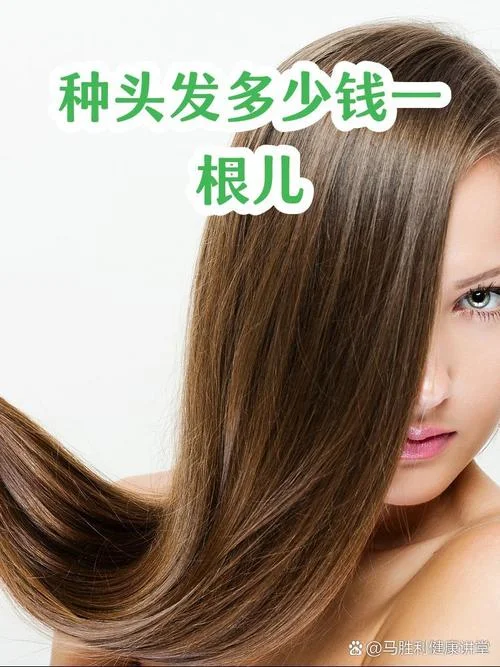种头发需要多少钱种头发的价格-种头发价格