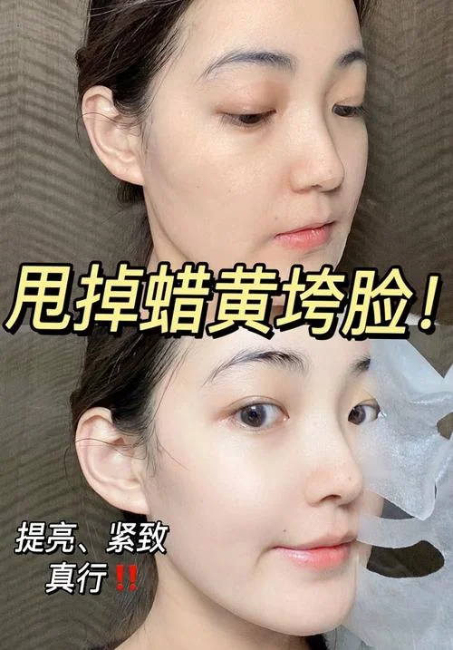 美白去皱纹面膜怎么做-10 字美白去皱面膜