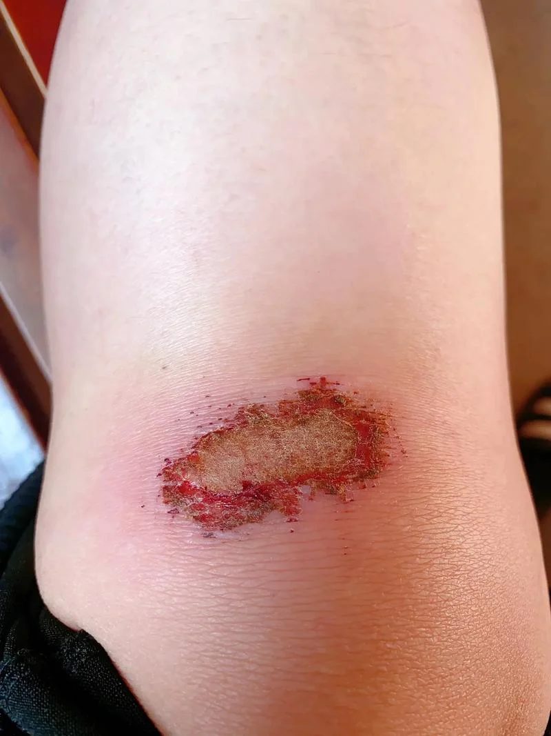 做梦梦到被蛇咬到小腿-梦中被蛇咬小腿