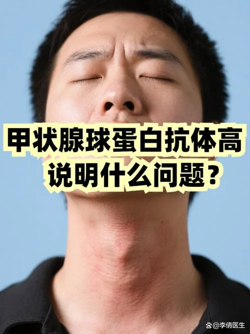 甲状腺球蛋白抗体小于1.3是什么意思_2