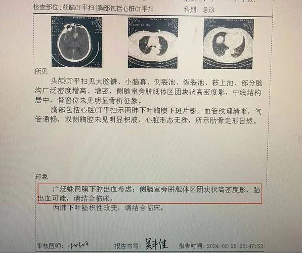 大脑ct检查多少钱-大脑 CT 检查费
