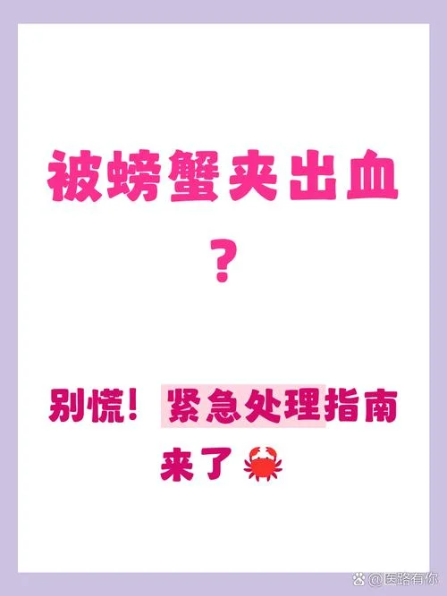 梦见被螃蟹夹手求解_2