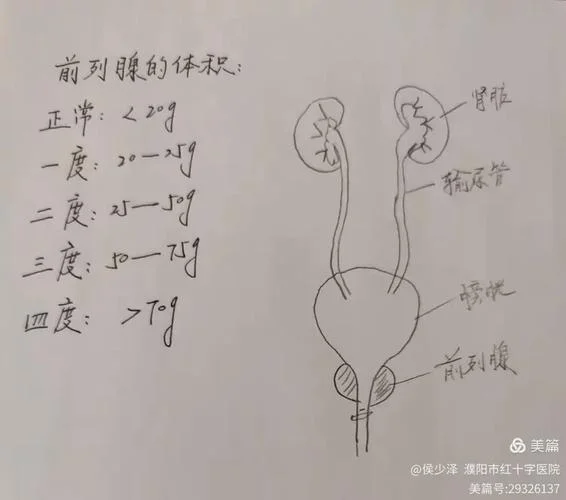 前列腺脓肿手术多少钱_2