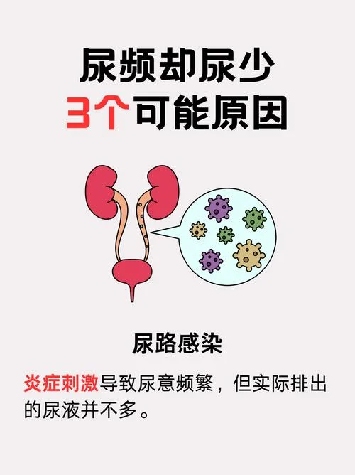 经常尿急是什么意思-频繁尿急的含义