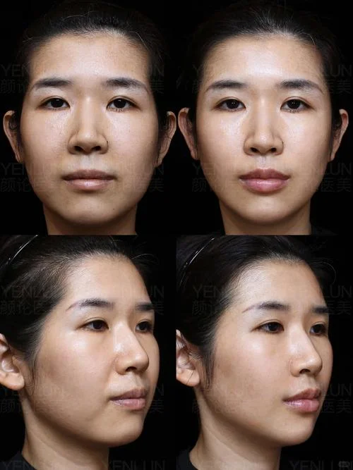 哪里可以学整容_1