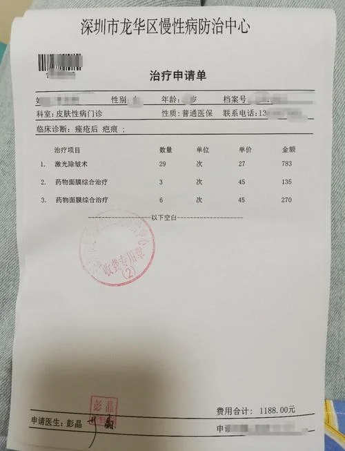 医院去痦子多少钱_1