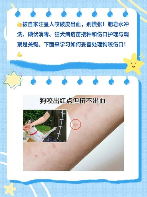 梦见自己让狗咬出血了_2