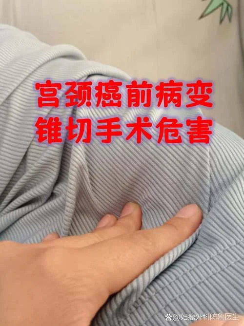 宫颈锥切需要多少钱_2