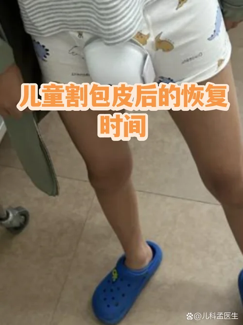 儿童包皮环切术_1