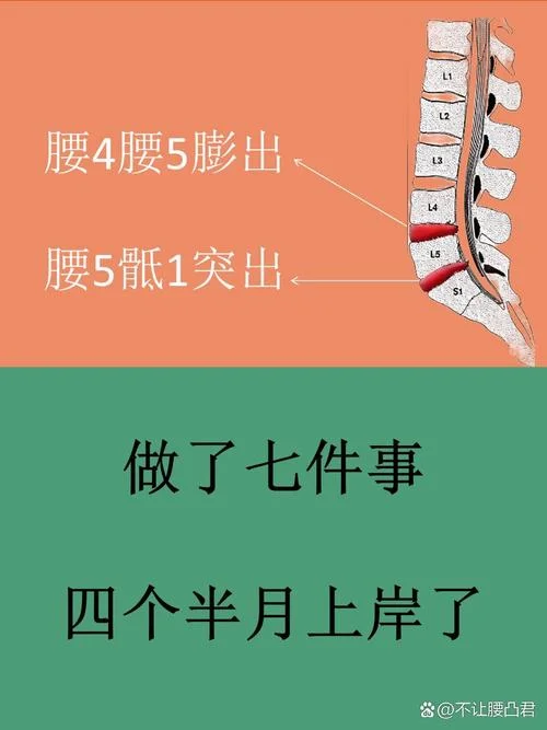 腰间盘突出梗下一句-突出缺一腿疼