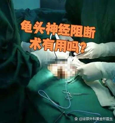 早泄神经阻断术多少钱-早泄神经阻断术价格