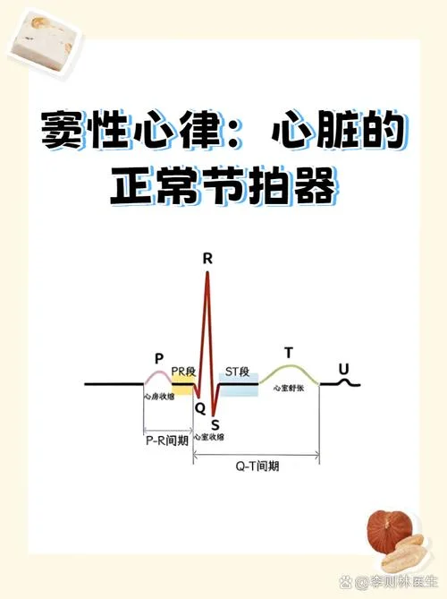 心电图 窦性心律什么意思-窦性心律正常