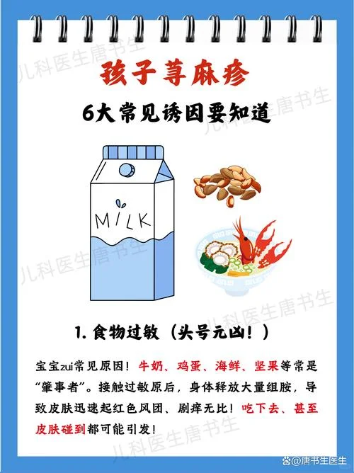 什么是小儿惊风_1