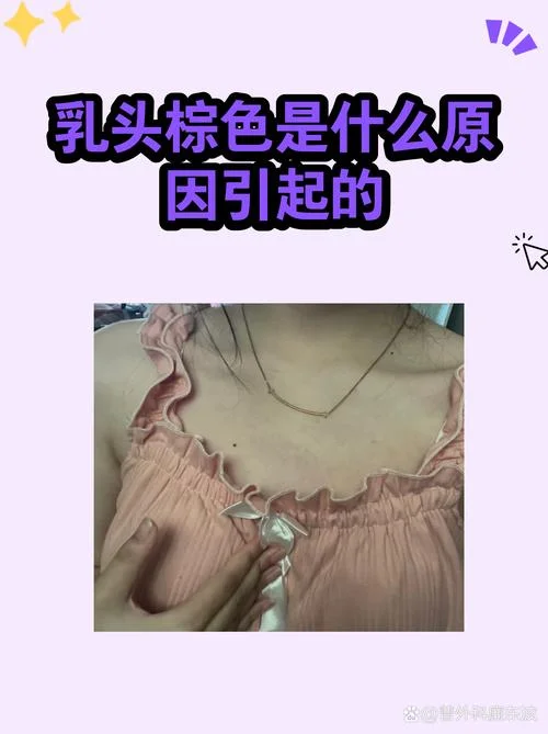 乳头周围黑怎么办_1